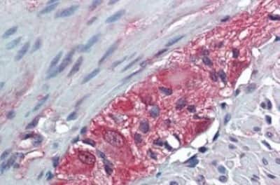 Immunohistochemistry-Paraffin: TXLNB Antibody [NBP3-14509] - TXLNB antibody IHC of human colon, ganglion cells. Immunohistochemistry of formalin-fixed, paraffin-embedded tissue after heat-induced antigen retrieval.